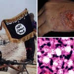 ISIS