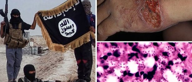 ISIS
